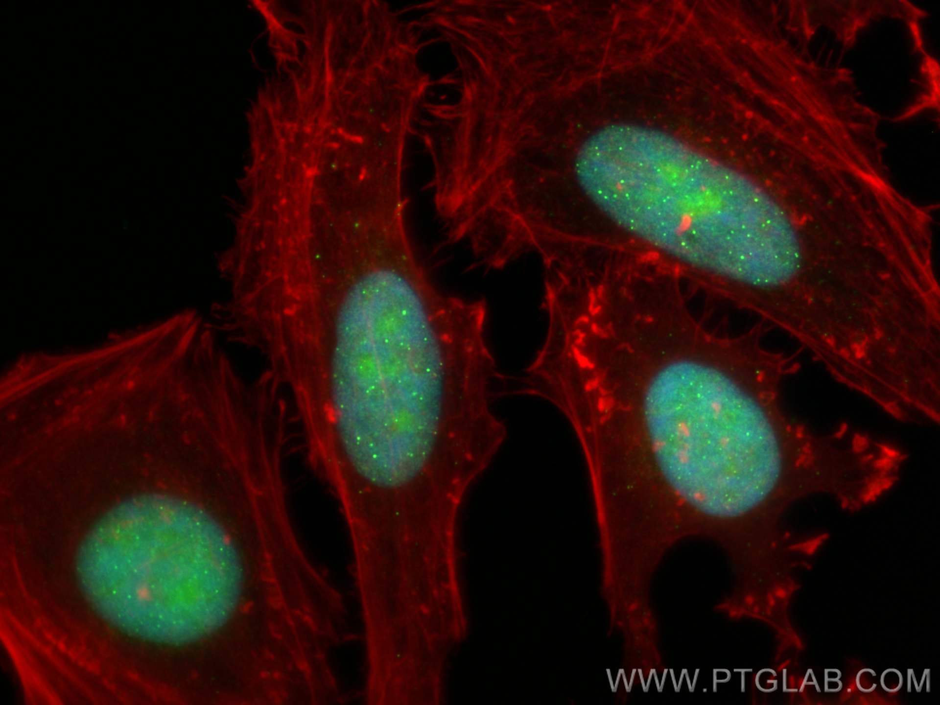 IF Staining of HeLa using 14595-1-AP