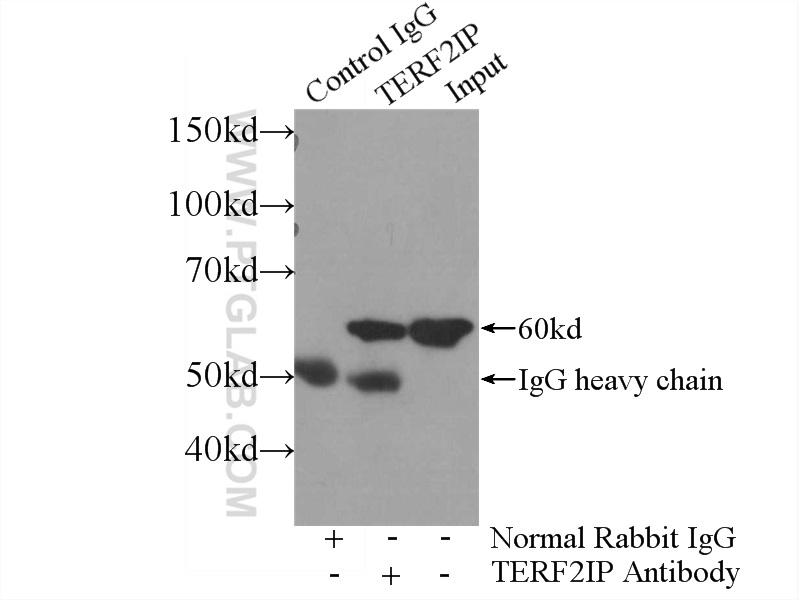 IP experiment of HeLa using 14595-1-AP