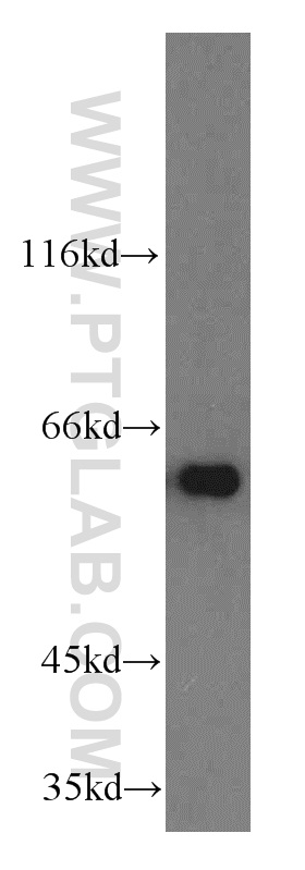 WB analysis of HEK-293 using 14595-1-AP