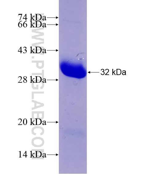 TES fusion protein Ag28548 SDS-PAGE