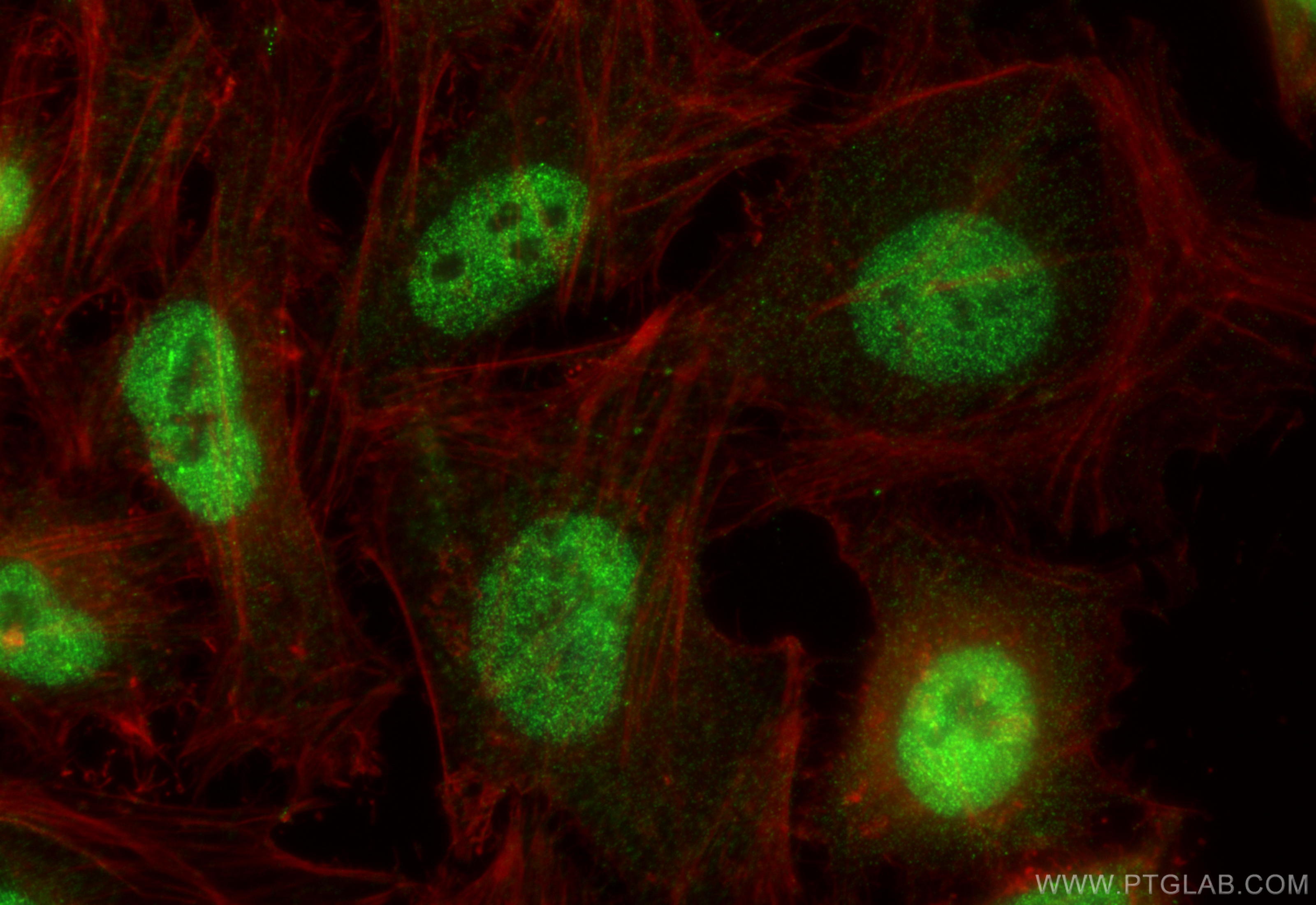 IF Staining of HeLa using 21207-1-AP