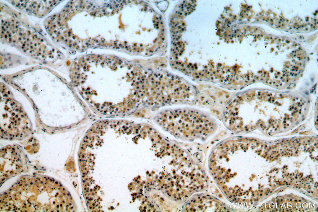 IHC staining of human testis using 18888-1-AP