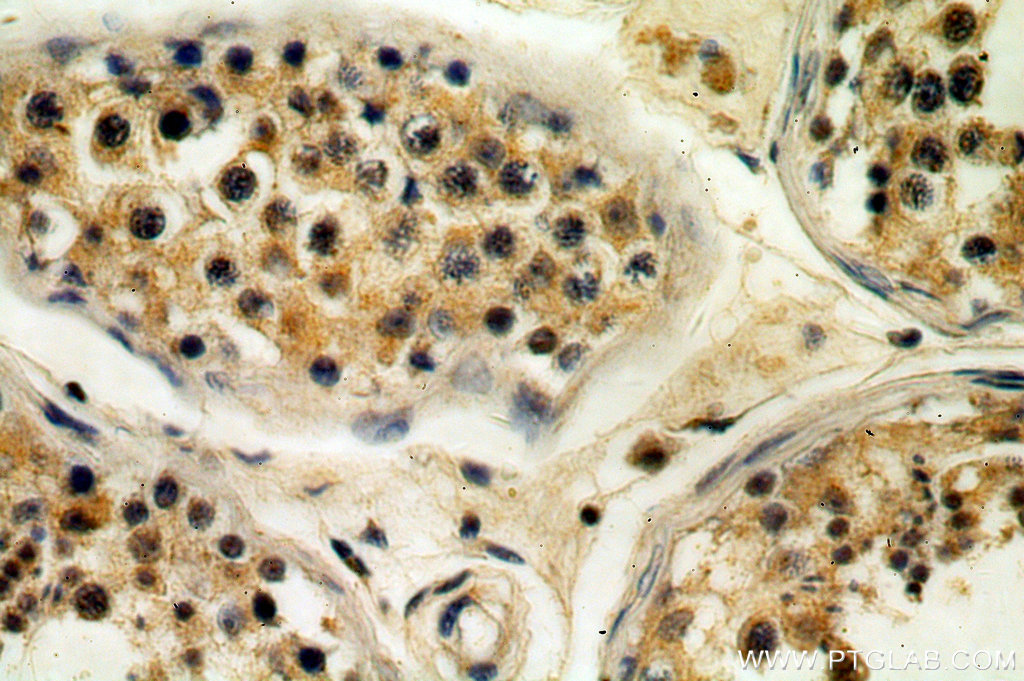 IHC staining of human testis using 18888-1-AP