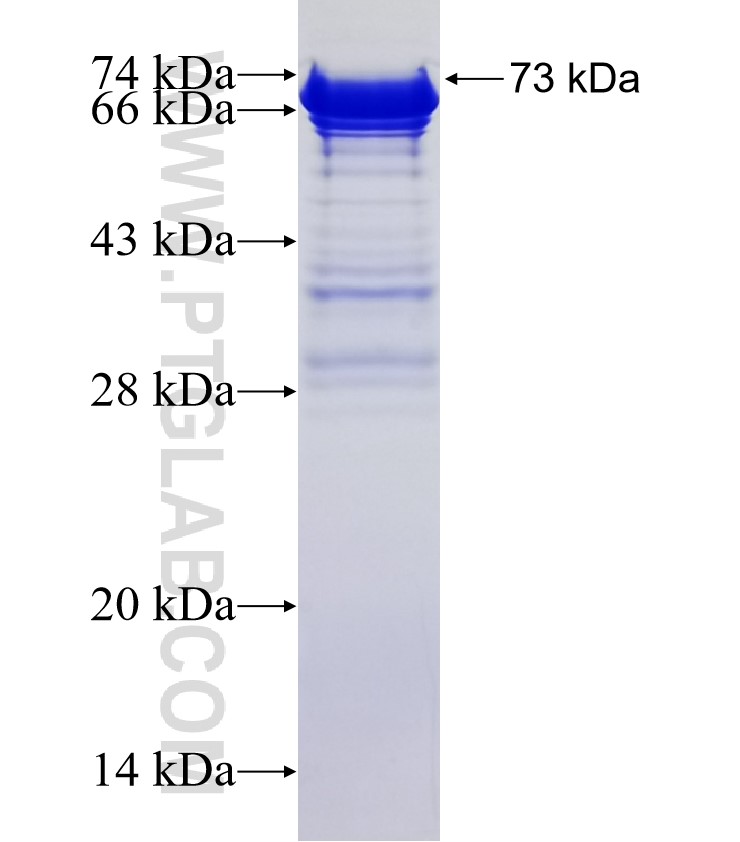 TEX13A fusion protein Ag13468 SDS-PAGE