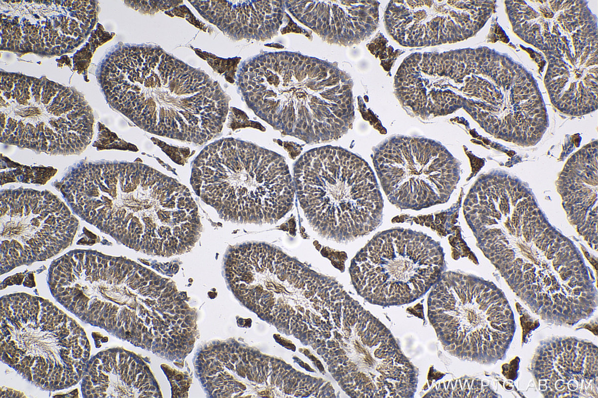 IHC staining of mouse testis using 24585-1-AP