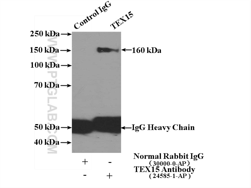 IP experiment of PC-3 using 24585-1-AP