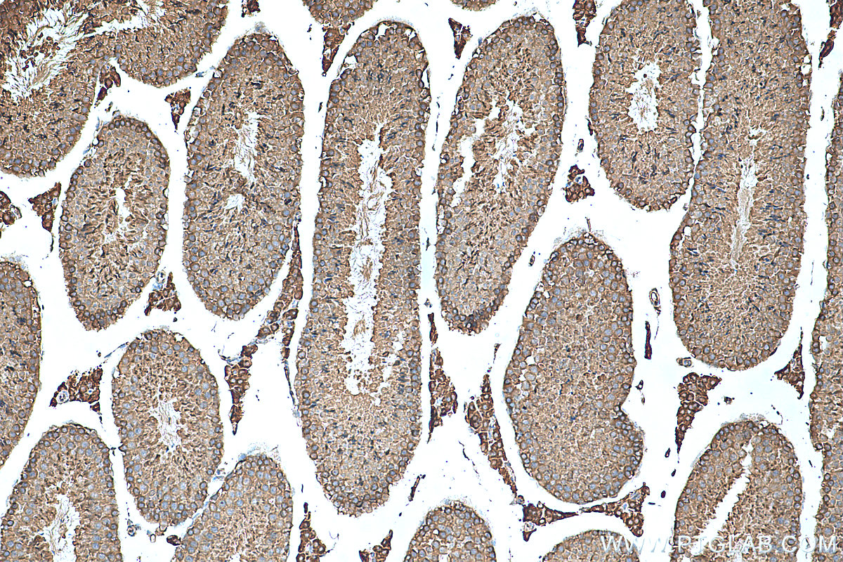 IHC staining of mouse testis using 25858-1-AP