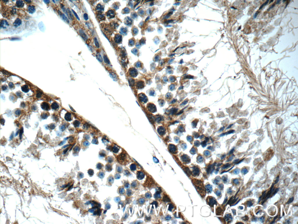IHC staining of mouse testis using 25858-1-AP