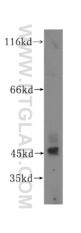 WB analysis of human testis using 16991-1-AP