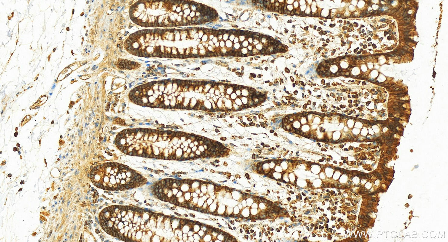 IHC staining of human colon using 17435-1-AP