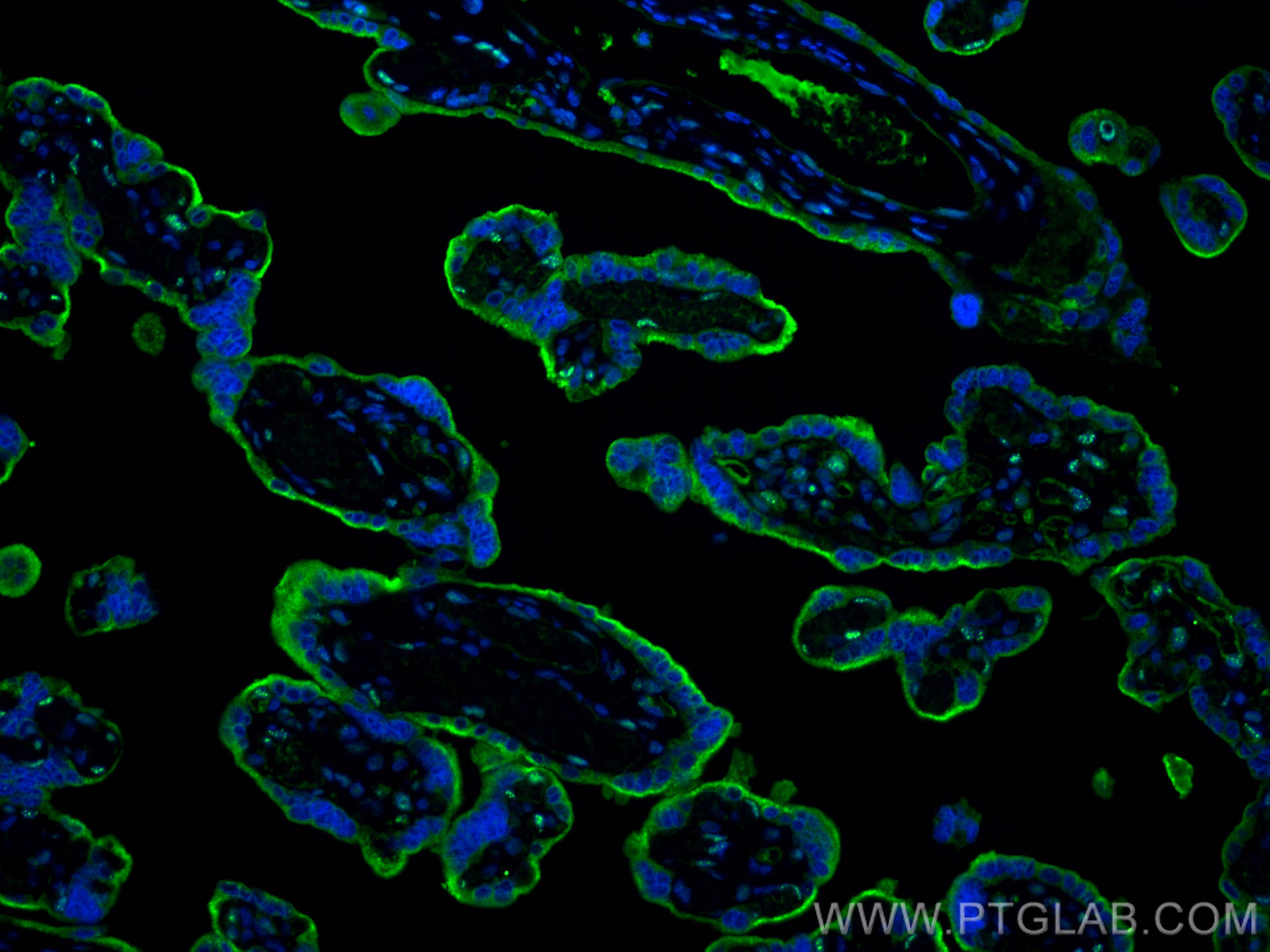 IF Staining of human placenta using 66171-1-Ig