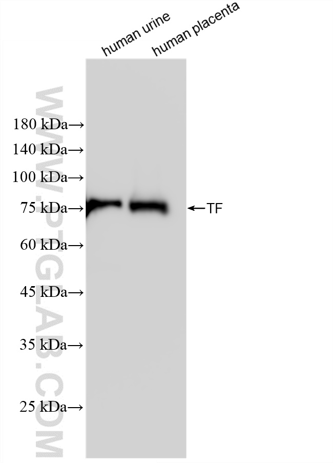 WB analysis of human urine using 84386-5-RR