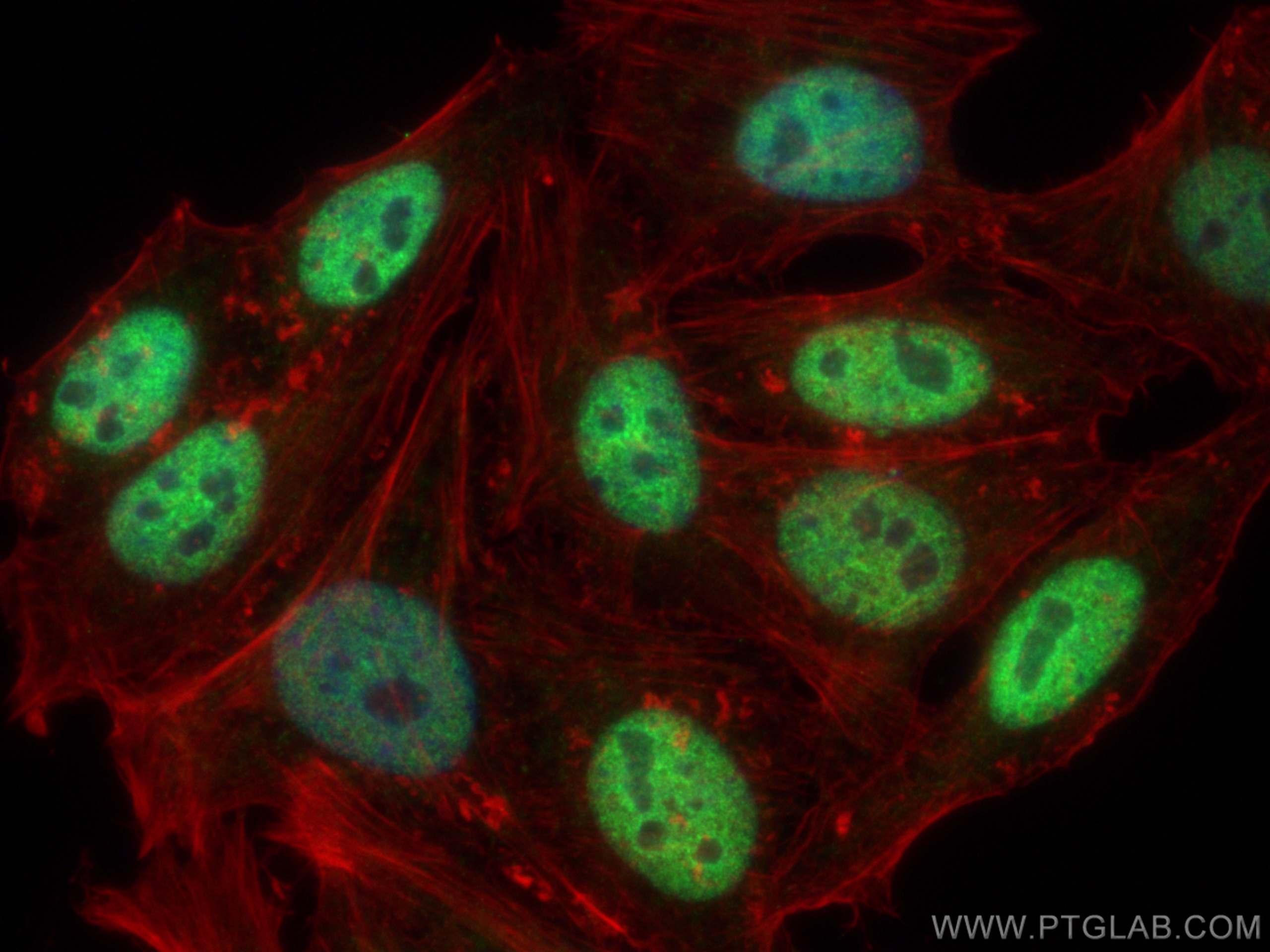 IF Staining of HepG2 using 13019-3-AP