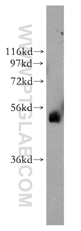 WB analysis of MCF-7 using 13183-1-AP