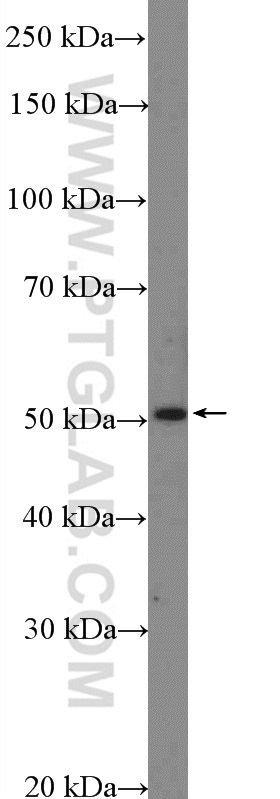 WB analysis of HeLa using 18835-1-AP