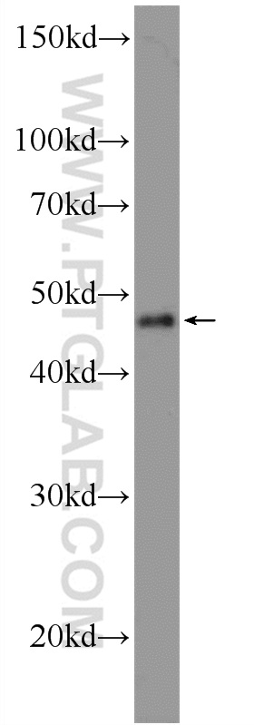 WB analysis of A375 using 25829-1-AP