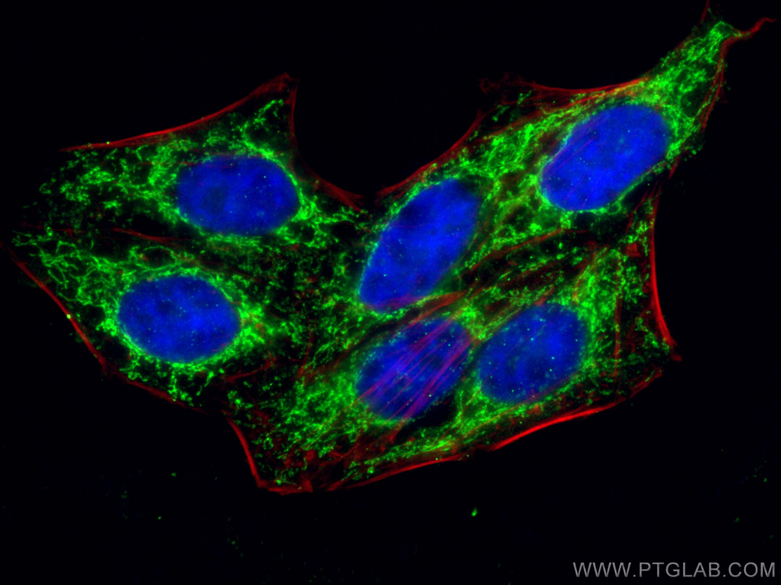 IF Staining of HepG2 using 16604-1-AP (same clone as 16604-1-PBS)