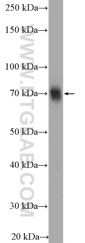 WB analysis of mouse spleen using 15203-1-AP