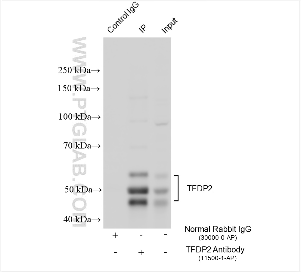 IP experiment of SH-SY5Y using 11500-1-AP