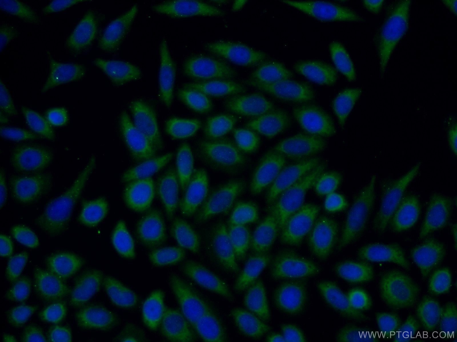 TFF1 Polyclonal antibody