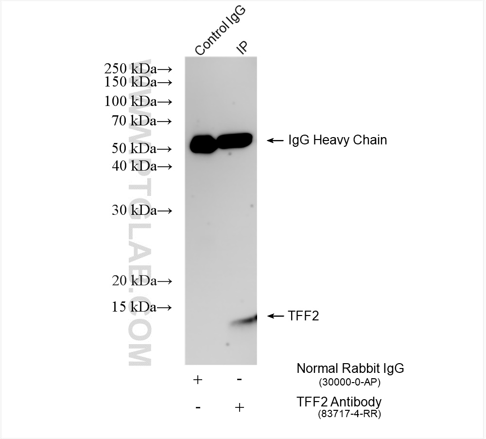 IP experiment of mouse stomach using 83717-4-RR