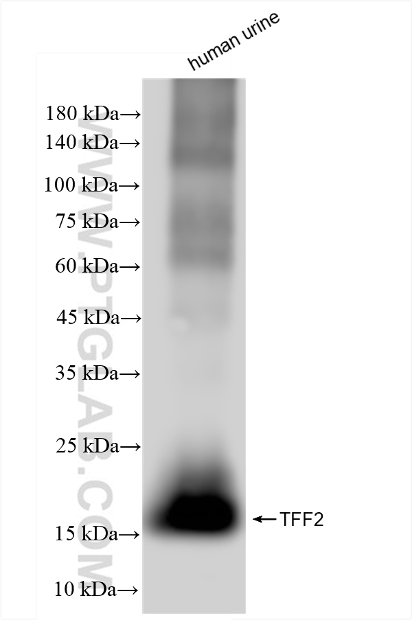 WB analysis of human urine using 83717-4-RR