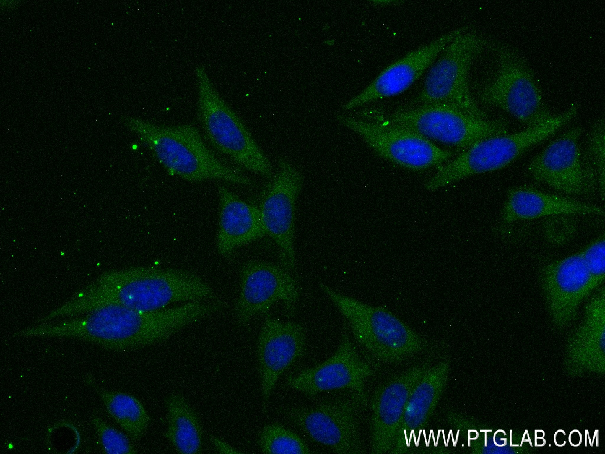 IF Staining of HepG2 using 83838-5-RR