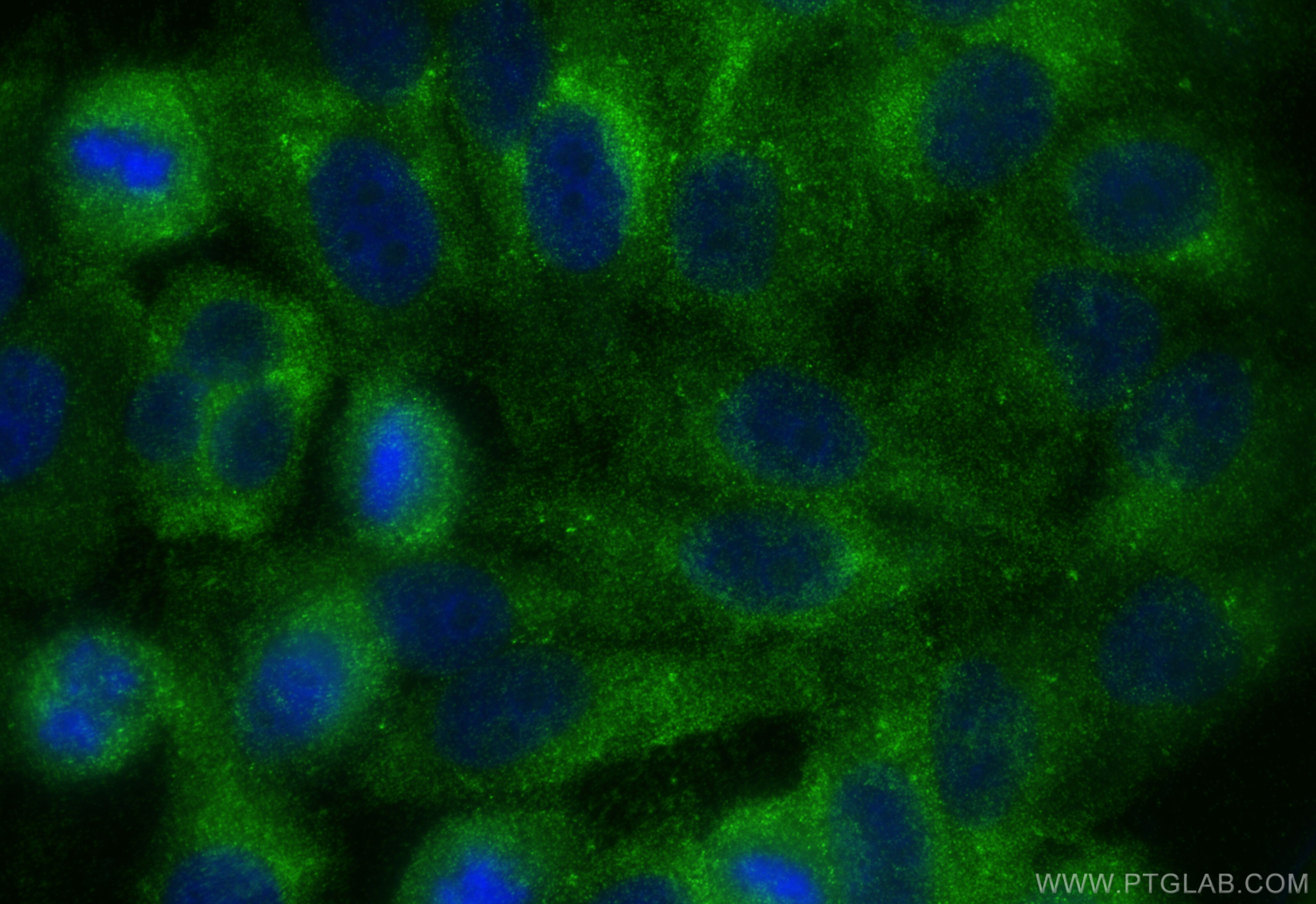 IF Staining of HepG2 using 83838-5-RR (same clone as 83838-5-PBS)