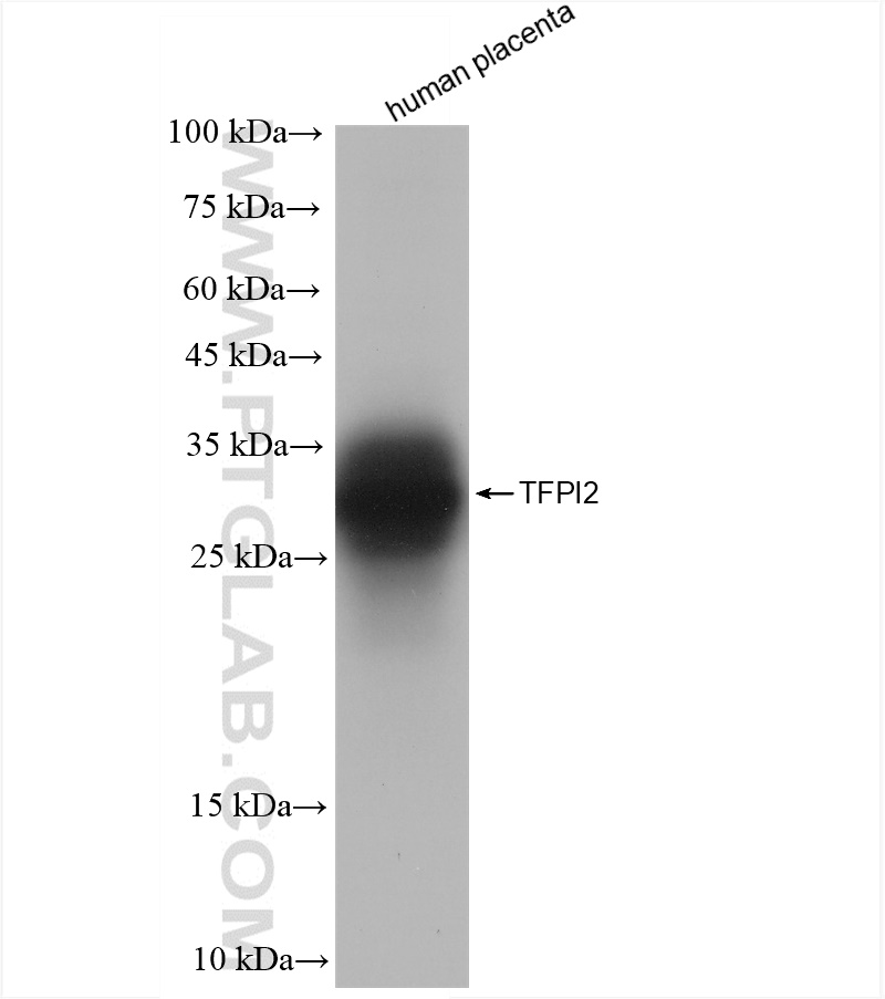 WB analysis of human placenta using 83279-1-RR (same clone as 83279-1-PBS)