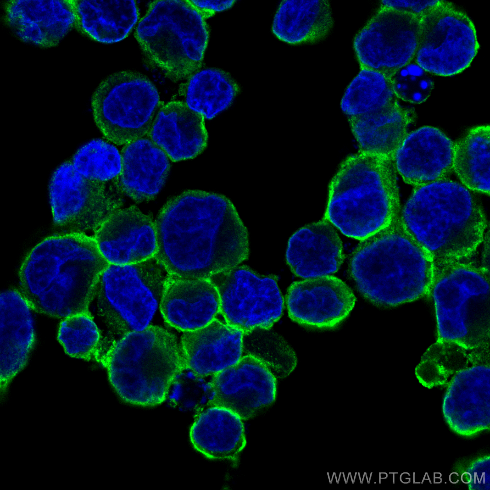 IF Staining of K-562 using 10084-2-AP