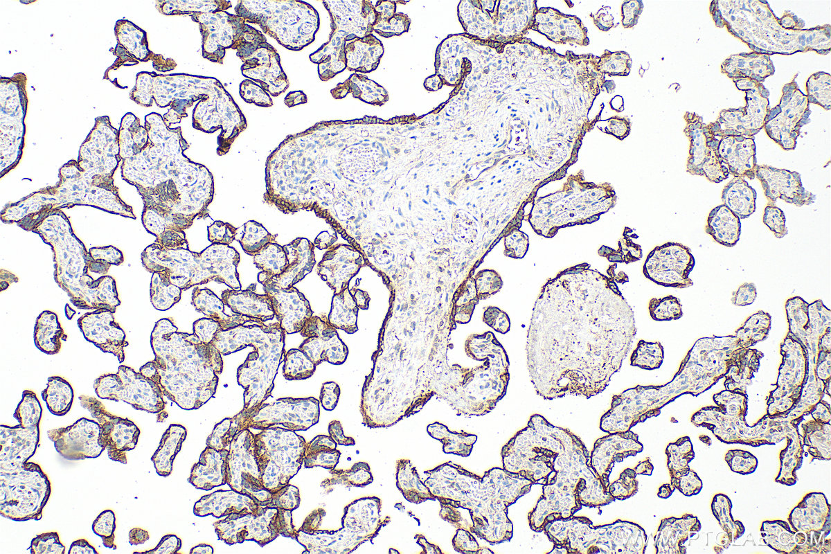 IHC staining of human placenta using 10084-2-AP