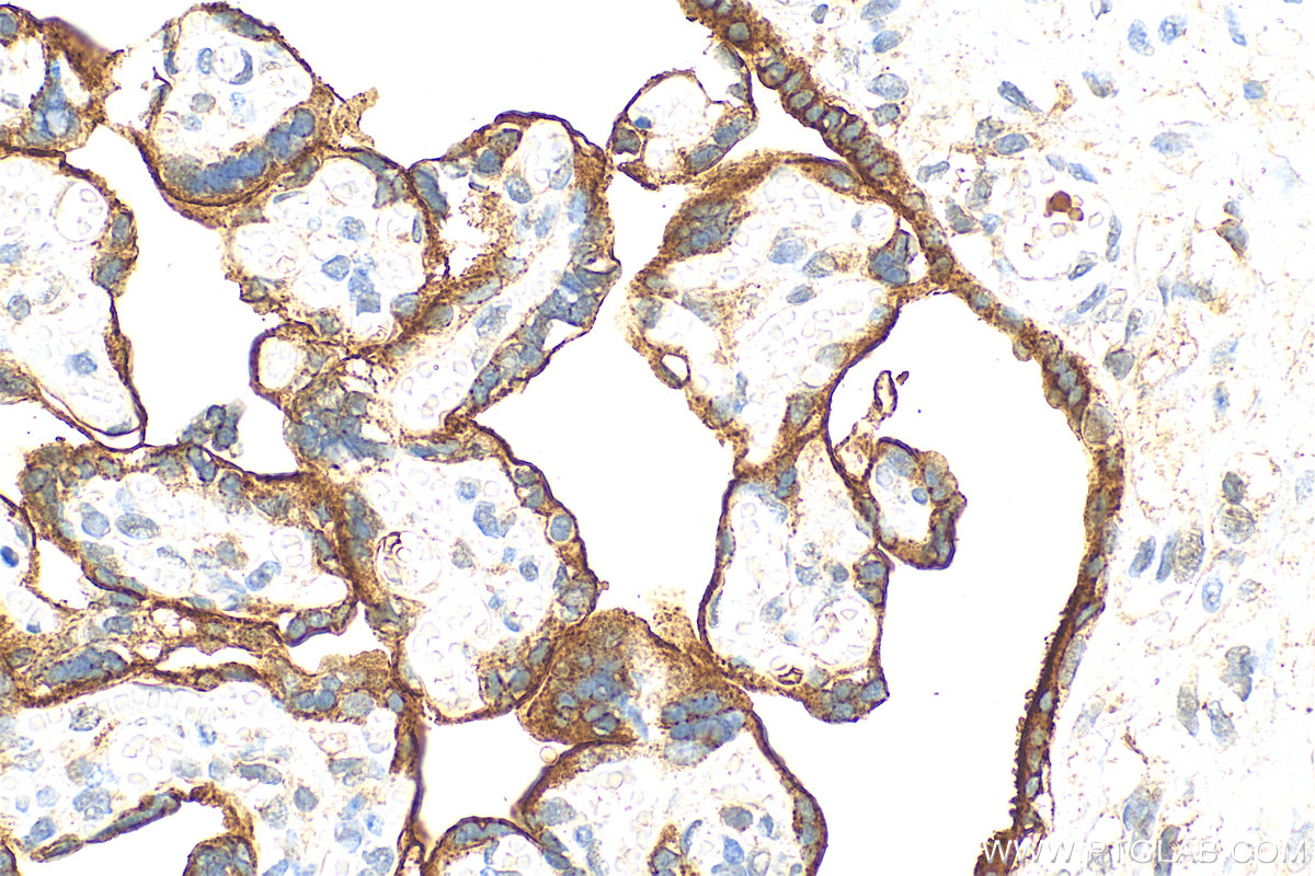 IHC staining of human placenta using 10084-2-AP