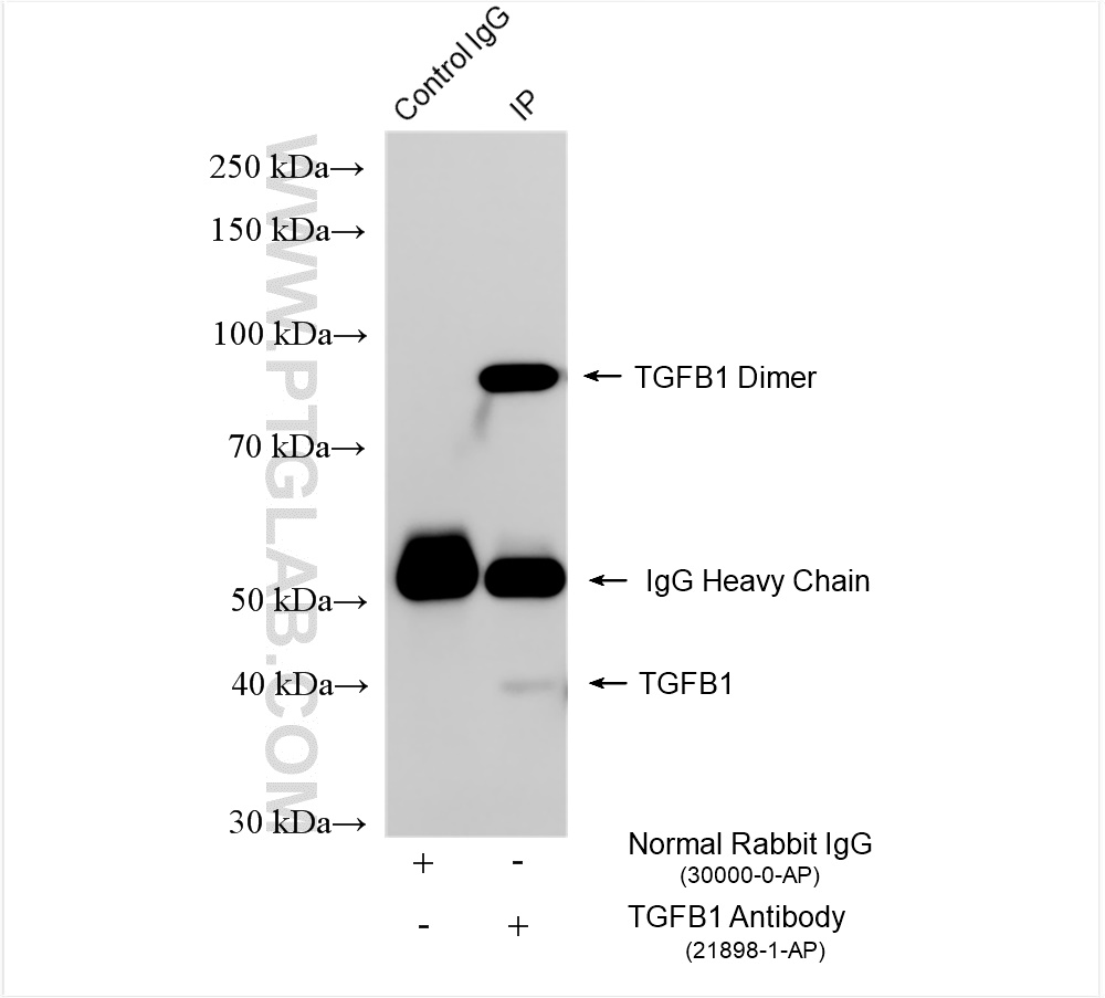 IP experiment of mouse skin using 21898-1-AP