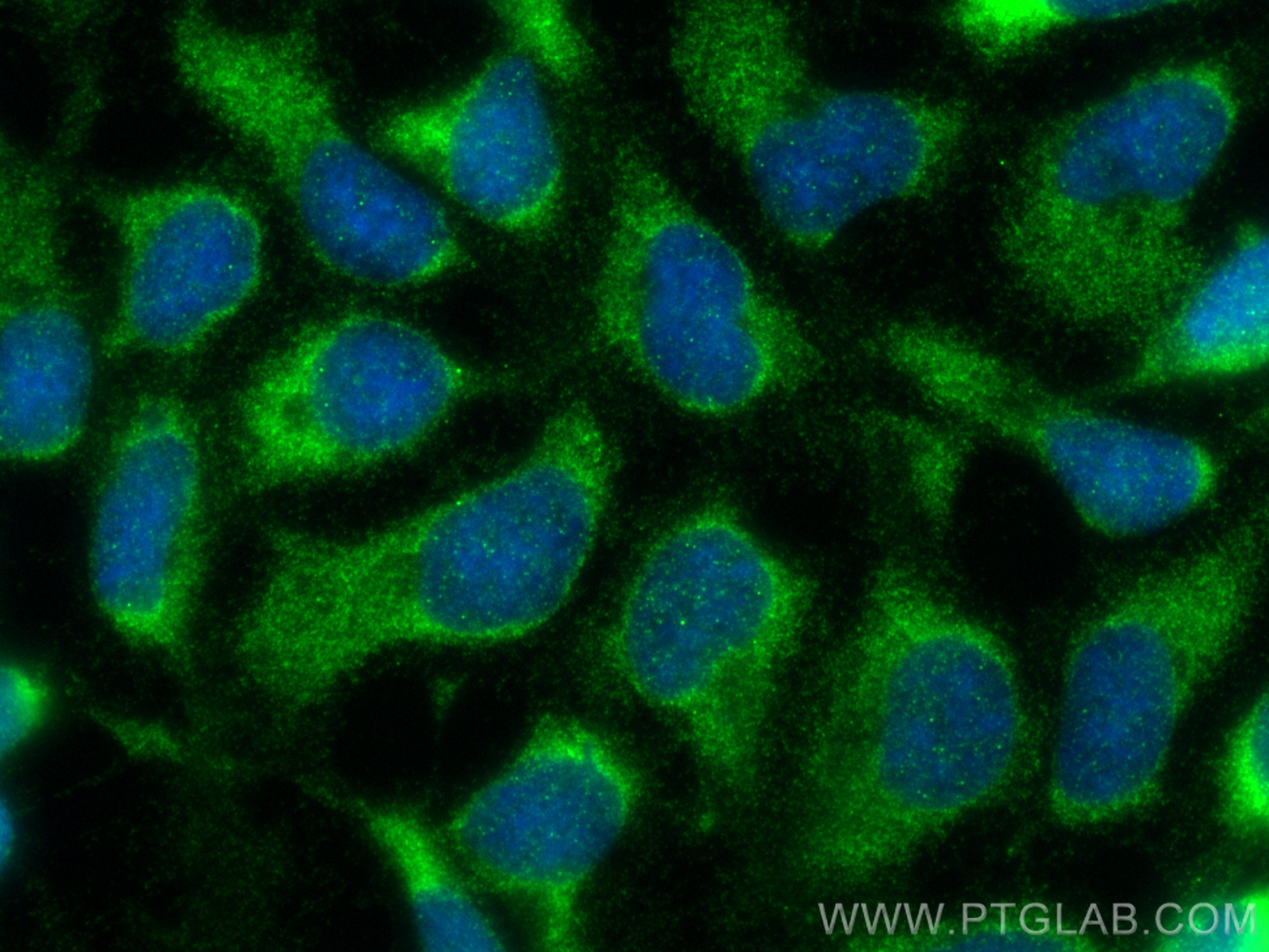 IF Staining of HEK-293 using 81746-2-RR (same clone as 81746-2-PBS)