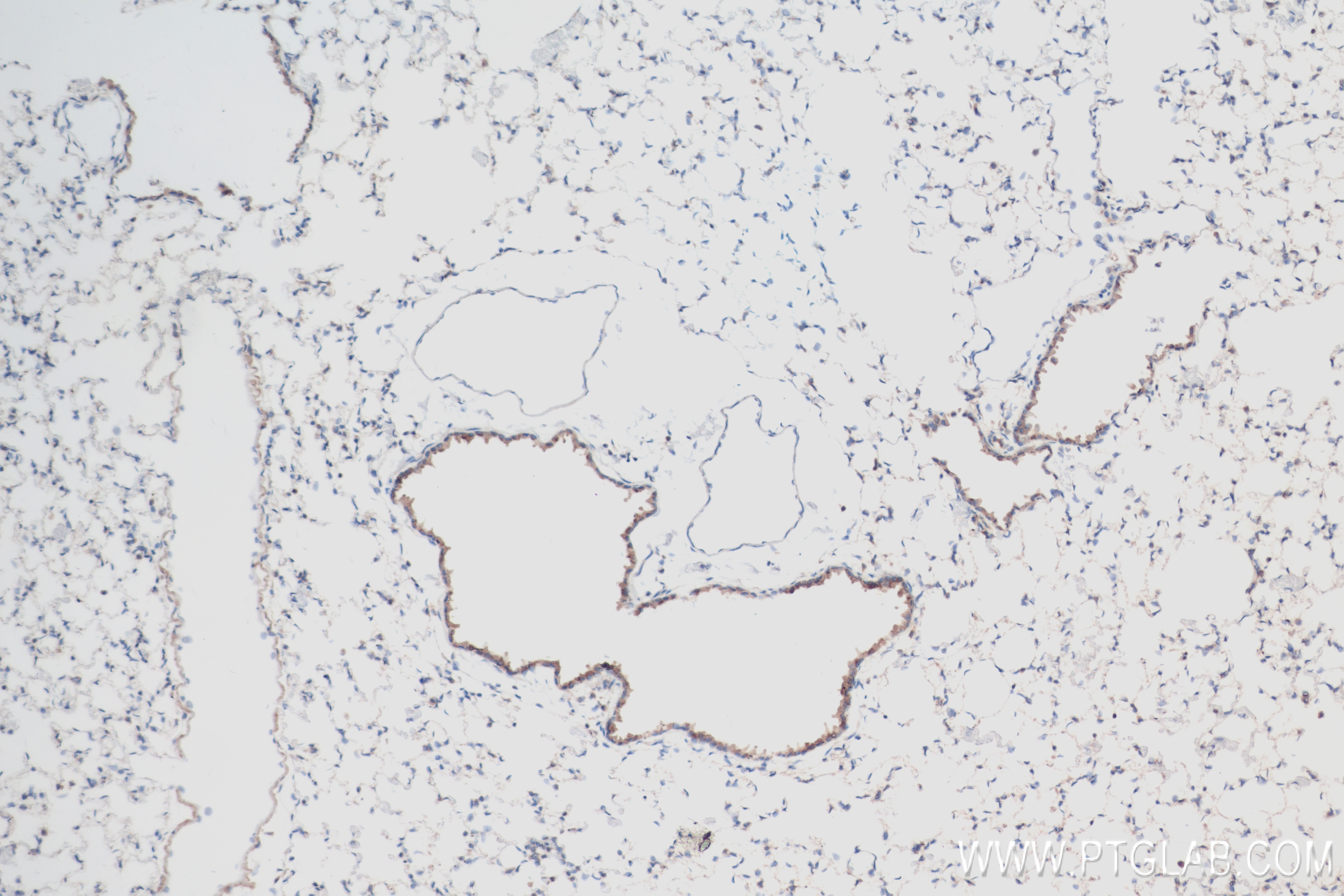 IHC staining of mouse lung using 81746-2-RR (same clone as 81746-2-PBS)