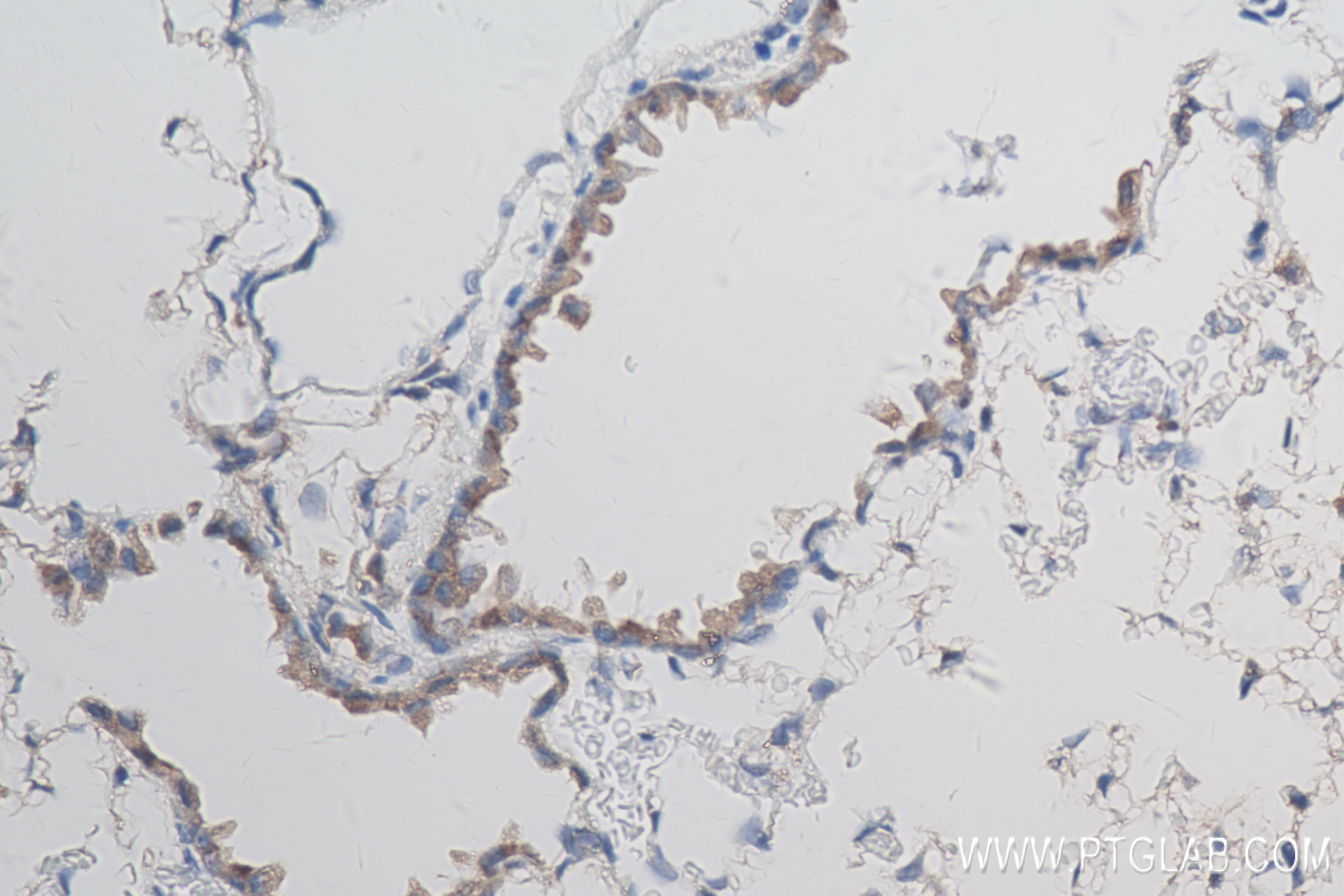 IHC staining of mouse lung using 81746-2-RR (same clone as 81746-2-PBS)