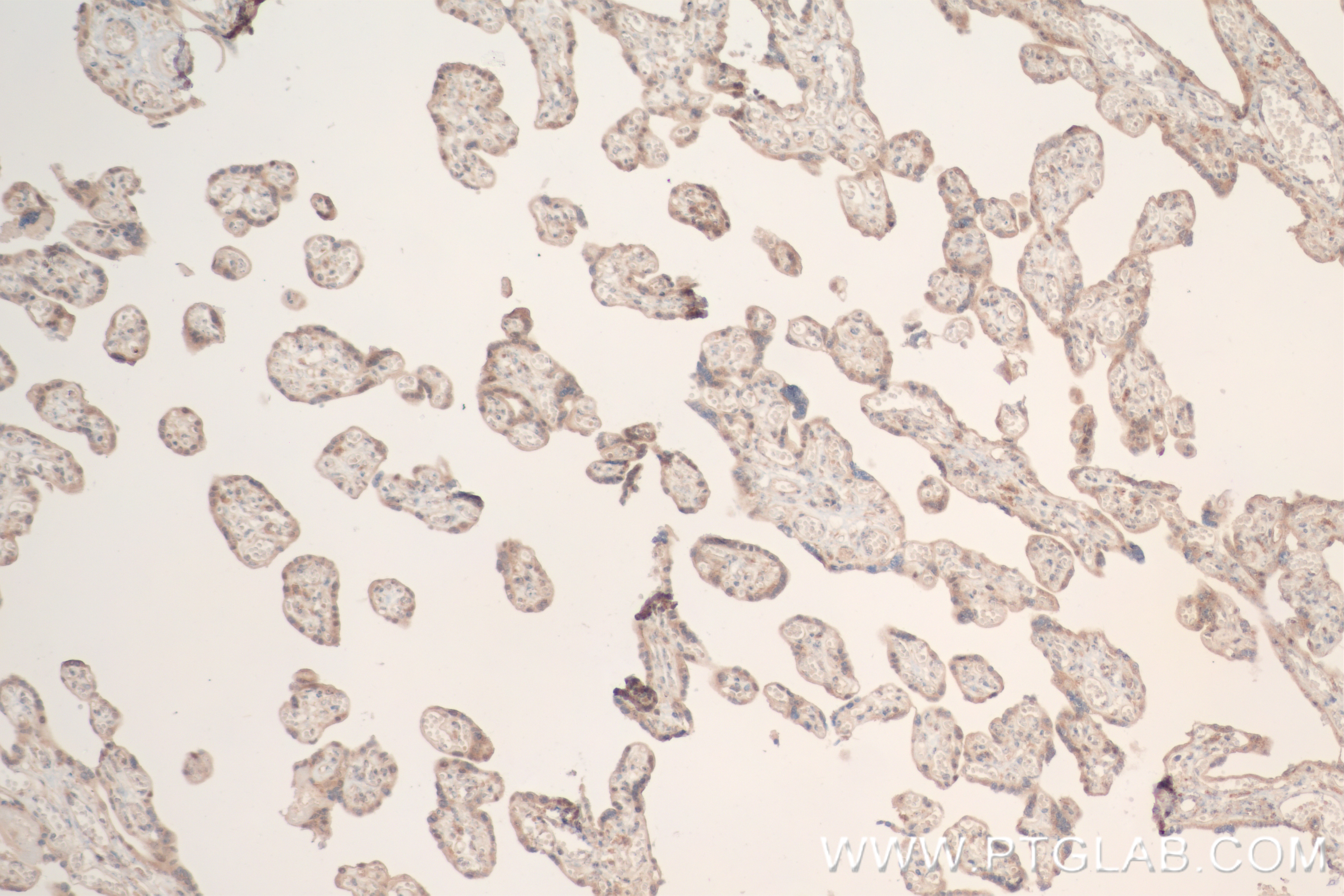 IHC staining of human placenta using 84453-1-RR