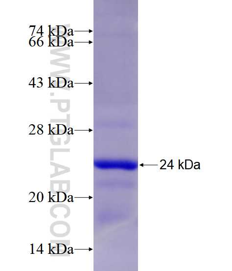 TGIF1 fusion protein Ag28509 SDS-PAGE