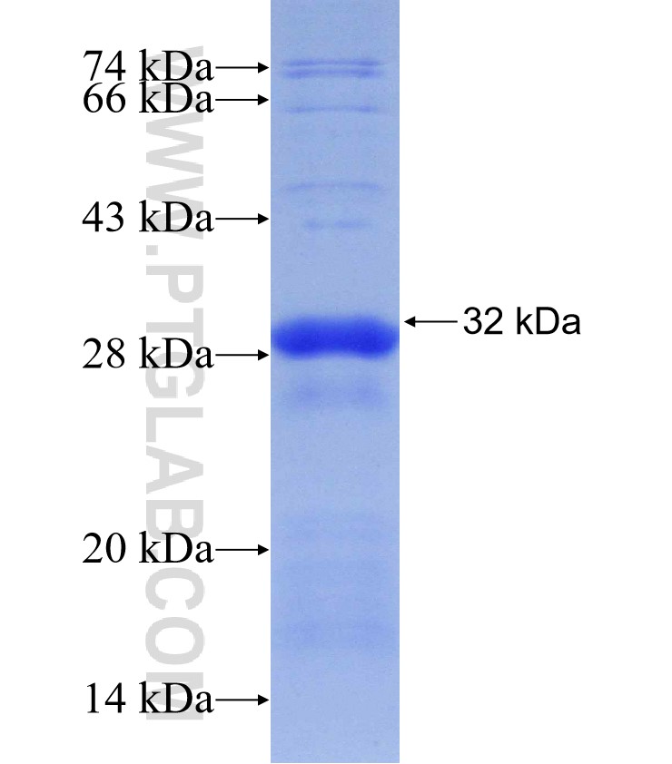 TGIF2 fusion protein Ag30083 SDS-PAGE