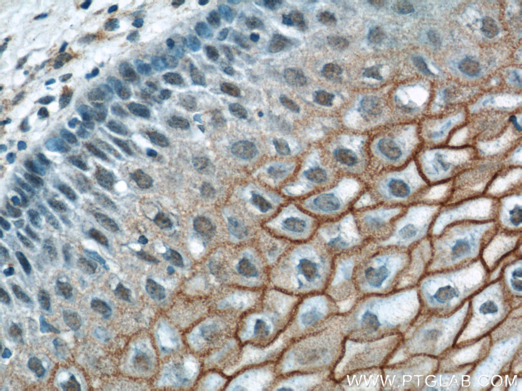 IHC staining of human cervix using 12912-3-AP