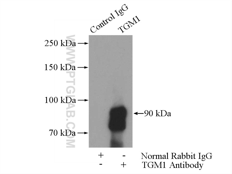 IP experiment of mouse kidney using 12912-3-AP