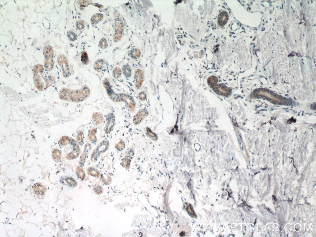 IHC staining of human skin using 25071-1-AP