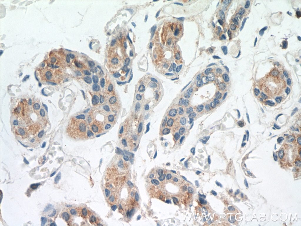 IHC staining of human skin using 25071-1-AP