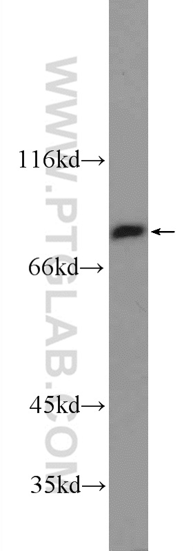 WB analysis of mouse skin using 25071-1-AP