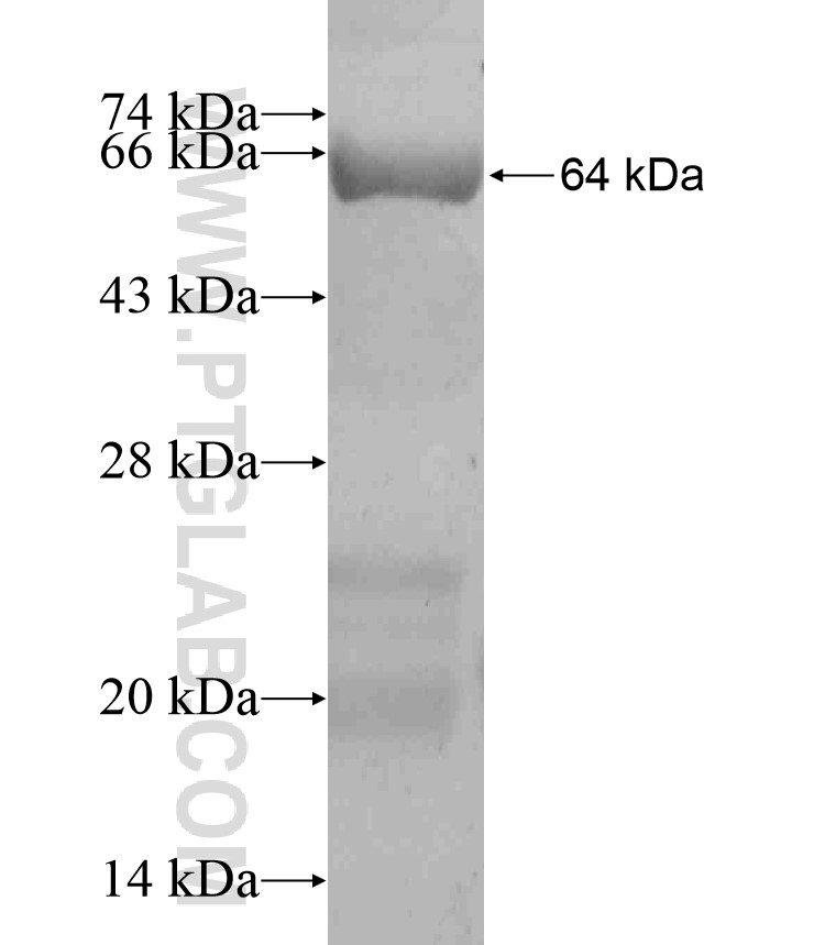 TGM5 fusion protein Ag18492 SDS-PAGE