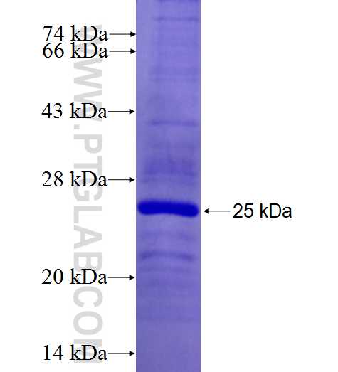 TGM7 fusion protein Ag26963 SDS-PAGE