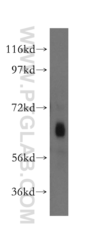 WB analysis of A549 using 11226-1-AP