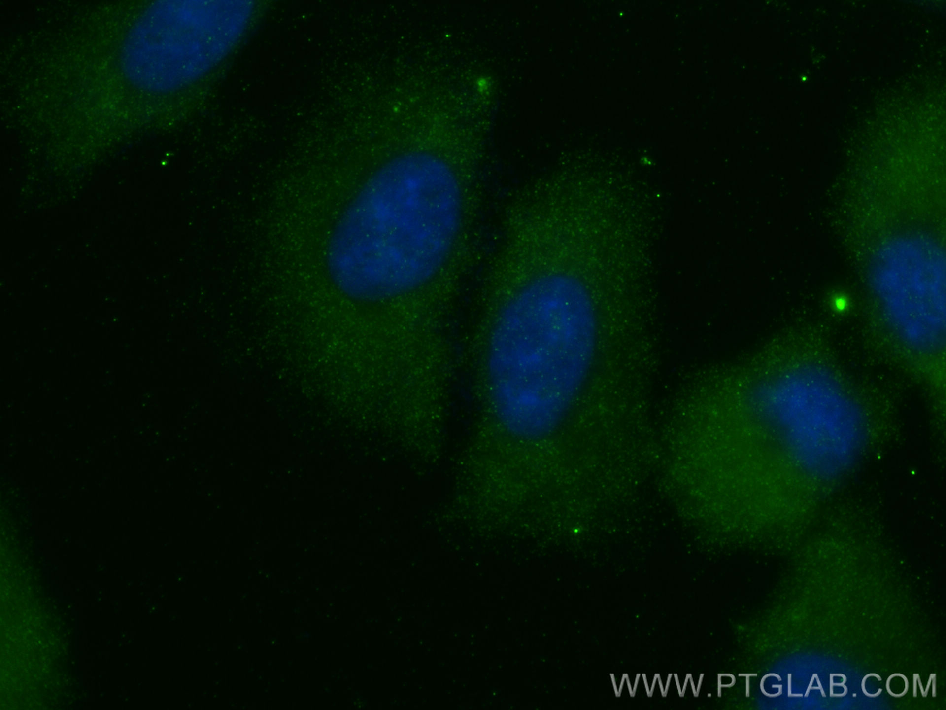 IF Staining of A549 using 12909-1-AP