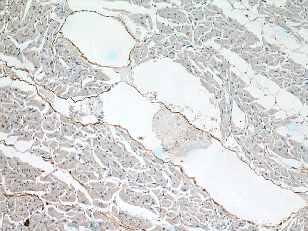 IHC staining of human heart using 14318-1-AP