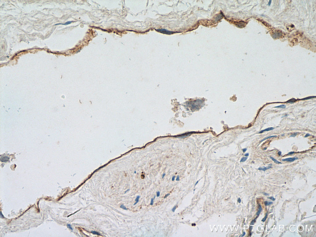 IHC staining of human heart using 14318-1-AP